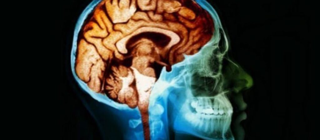 Tumori Cerebrali e Funzioni Cognitive