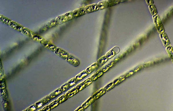 Colonie di Aphanizomenon, all'interno delle cellule si osservano vescicole contenenti granuli e accumuli di gas