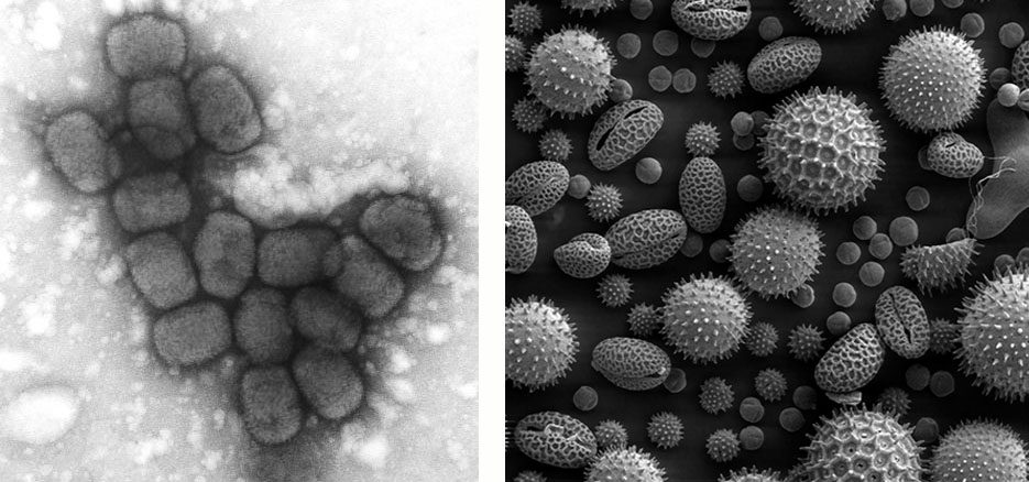 Microscopio Ottico vs. Microscopio Elettronico: Differenze