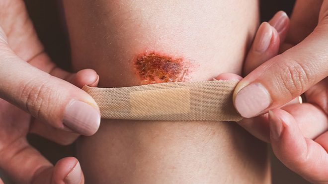 Deep wound?  here’s what to do