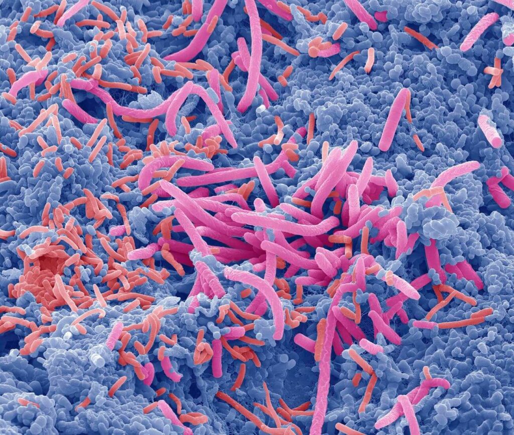 Germi intestino
