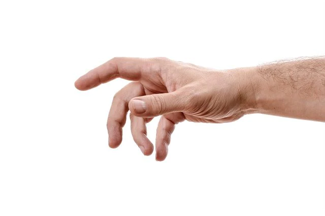 sindrome della mano aliena