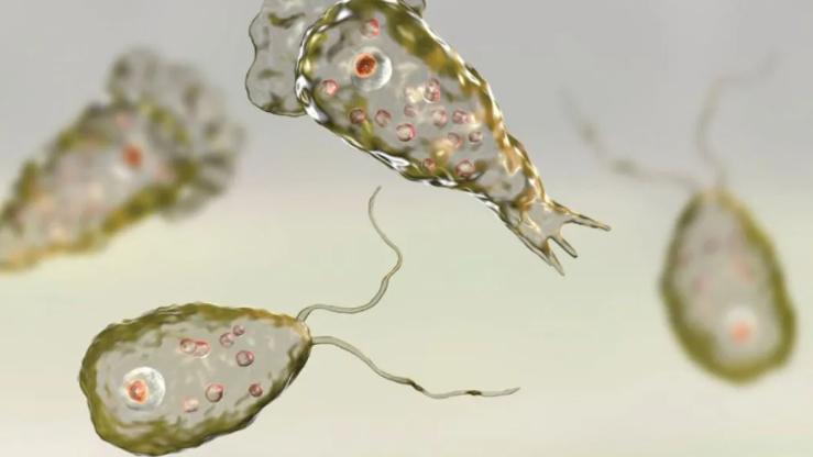 infezione da Acanthamoeba