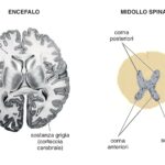 Immagine illustrativa della distribuzione della sostanza bianca e della sostanza grigia rispettivamente nell’encefalo e nel midollo spinale. la sostanza grigia è formata da corpi cellulari dei neuroni che appaiono grigi poiché privi di mielina. La sostanza bianca è formata, al contrario, da neuriti rivestiti da mielina. Nell’encefalo, la sostanza grigia, più esterna, forma la corteccia cerebrale, nel midollo spinale la sostanza grigia, più interna, forma una sorta di H.