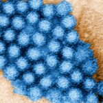 Norovirus contagio