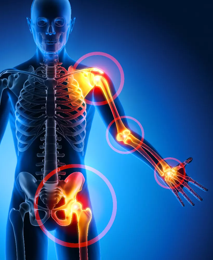 Proteggere le Articolazioni