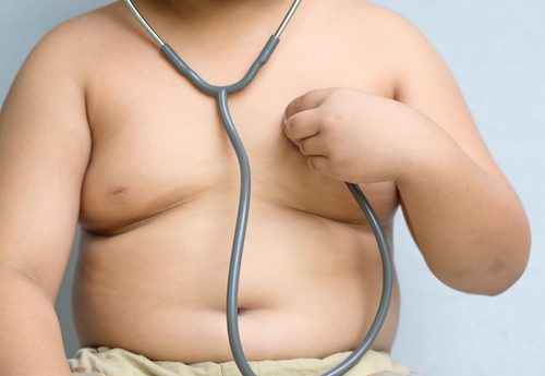 obesità grave durante infanzia