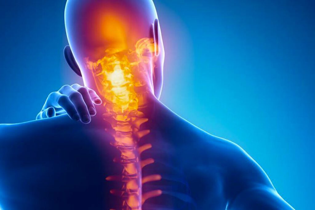 Quali sono i sintomi più gravi della cervicale?