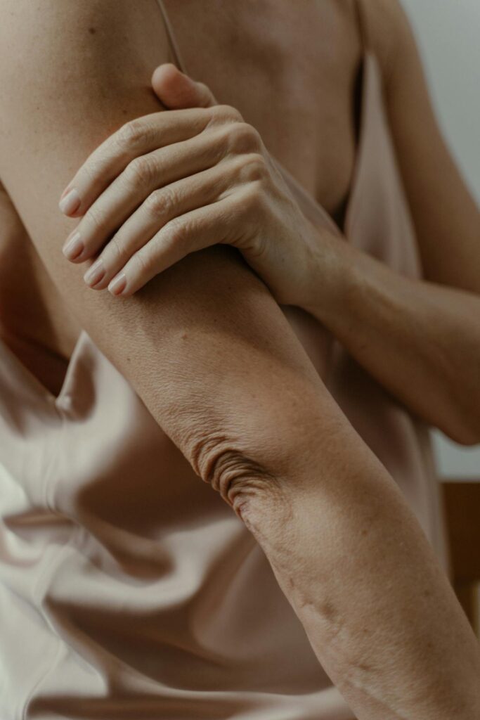 Dermatite ai gomiti: cause, sintomi e rimedi