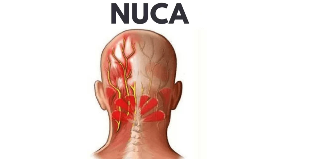 Dolore Dietro la Nuca: Cause e Trattamenti