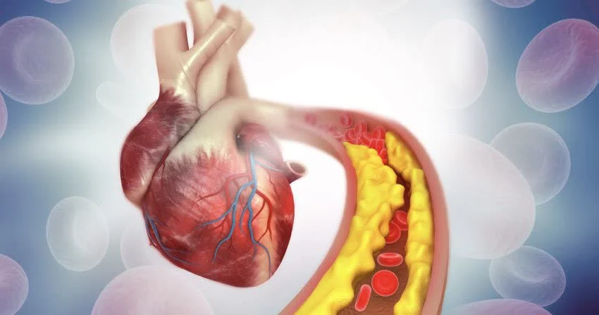 Ischemia cardiaca da stress: Cos’è e come gestirla