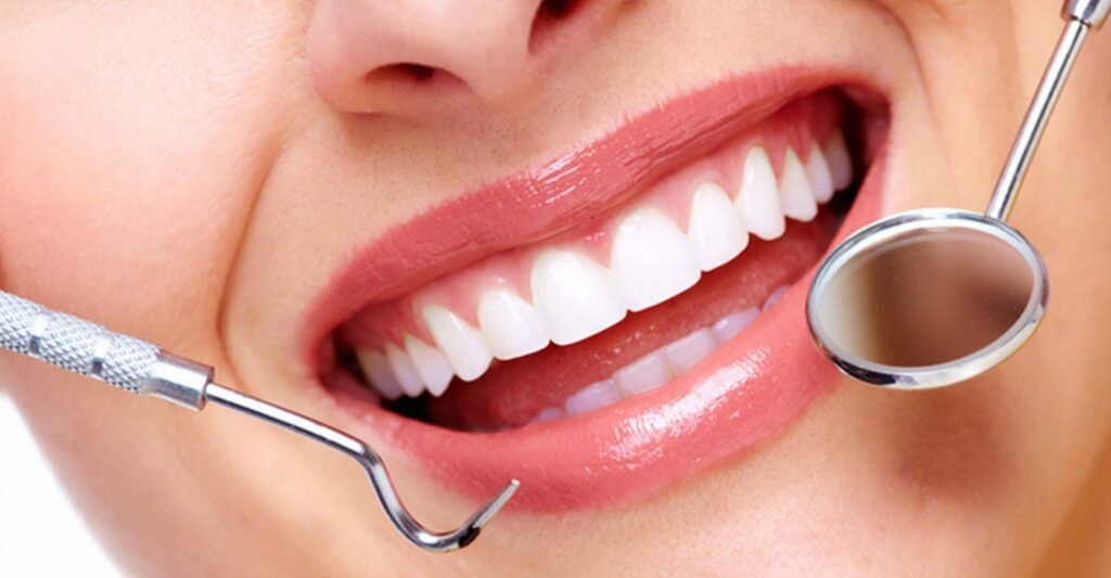 Prevenzione Dentale Igiene