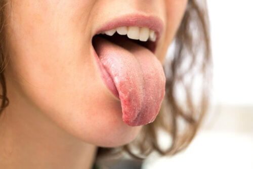 Diabete e Bocca Secca: Comprendere il Problema