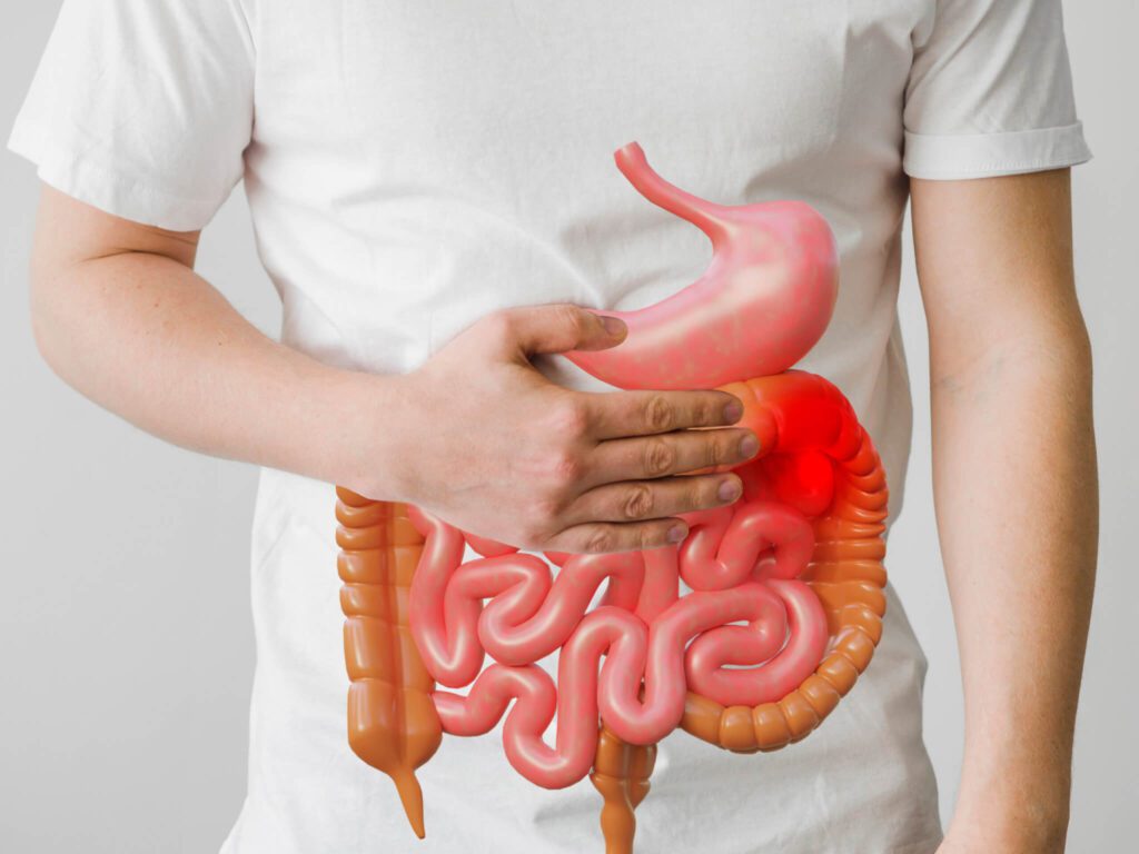 Dolore nel Colon Ascendente: Cause, Sintomi e Trattamenti