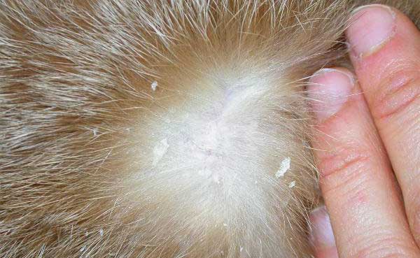 Dermatite Furfuracea: Cos&rsquo;&egrave;, Cause, Sintomi e Trattamenti