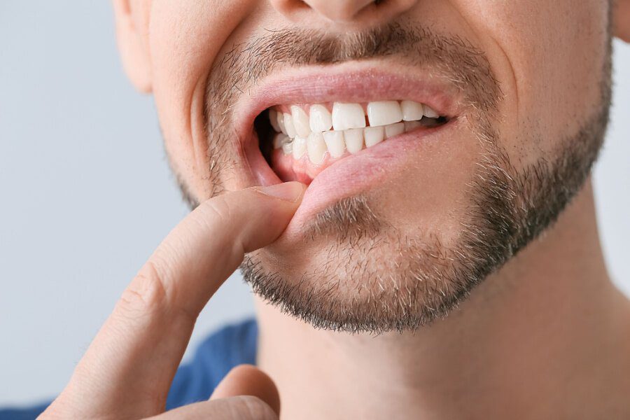Dolore Persistente alle Gengive: Cause, Sintomi e Trattamenti