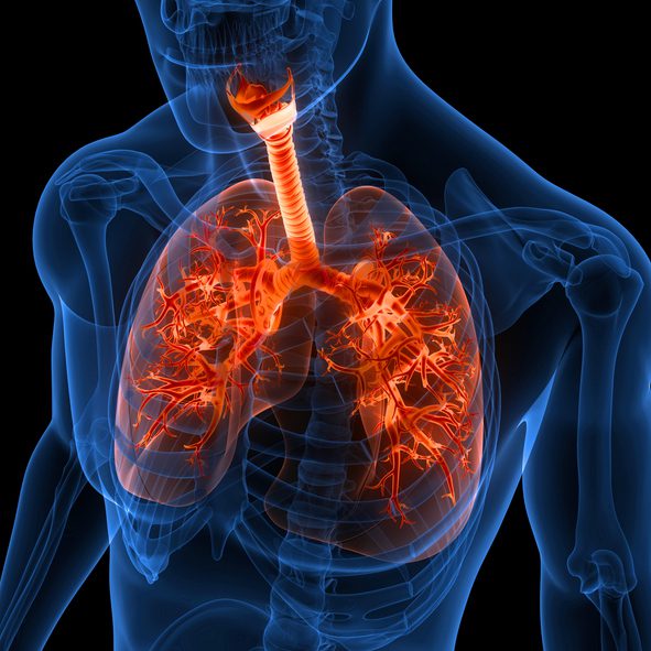 Enfisema apicale: sintomi, cause e trattamento
