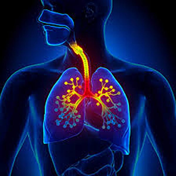 Enfisema Bolloso Congenito: Comprendere la Condizione