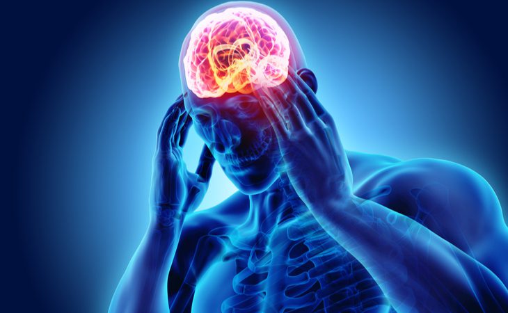 Ipertensione cerebrale: Cosa sapere