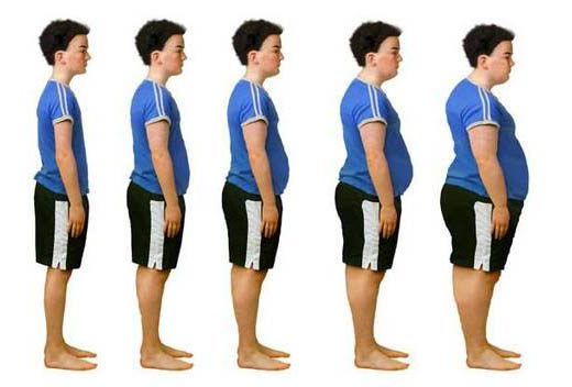 Obesit&agrave; di Classe 1: Definizione, Cause, Rischi e Trattamenti