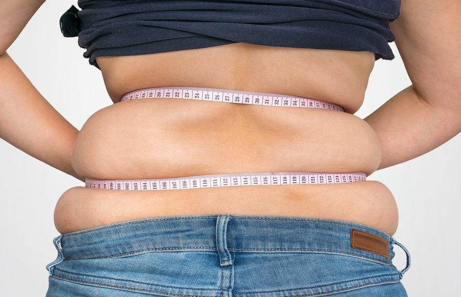 Obesit&agrave; Tronculare: Cause, Rischi e Strategie di Trattamento