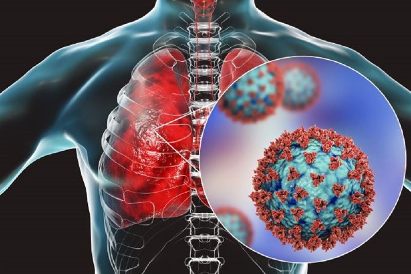 Attività fisica dopo la polmonite: linee guida per il recupero