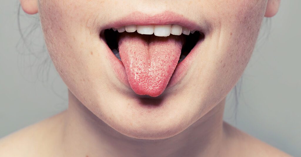 Alitosi e Bocca Amara: Cause, Rimedi e Trattamenti