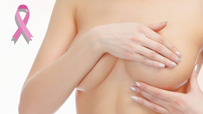 Nodulo Benigno al Seno: Cause, Diagnosi e Trattamento