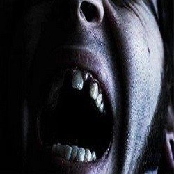 Denti che Cadono nei Sogni