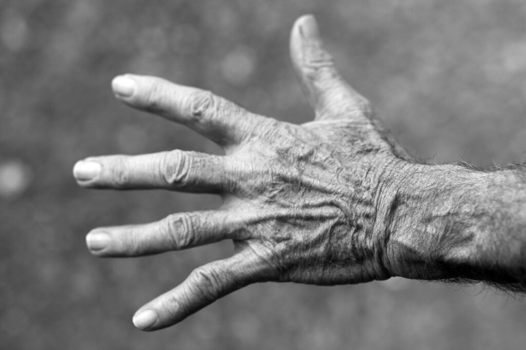 Artrosi della mano: sintomi, cause e trattamenti