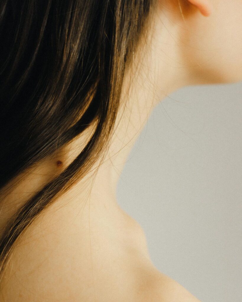 Macchie della pelle sul collo: cause, prevenzione e rimedi