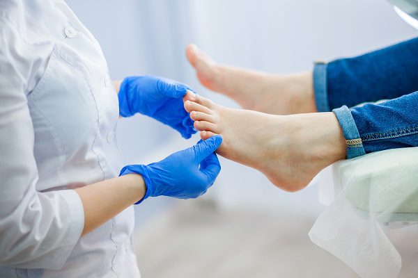 Micosi cutanea e terapia