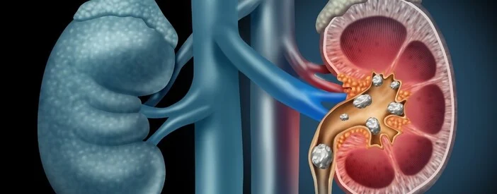 Problema al Pancreas e Blocco Renale