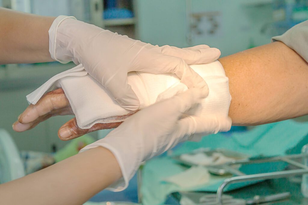 Trattamento per le Bruciature