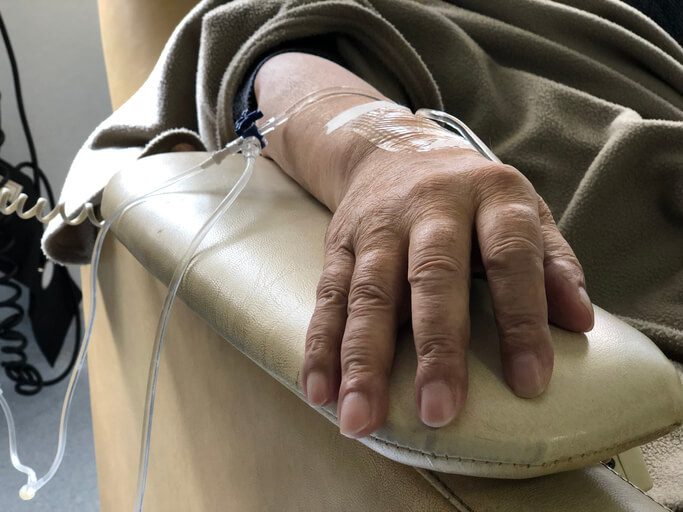 Bruciore di Stomaco Dopo Chemioterapia: Cause e Rimedi