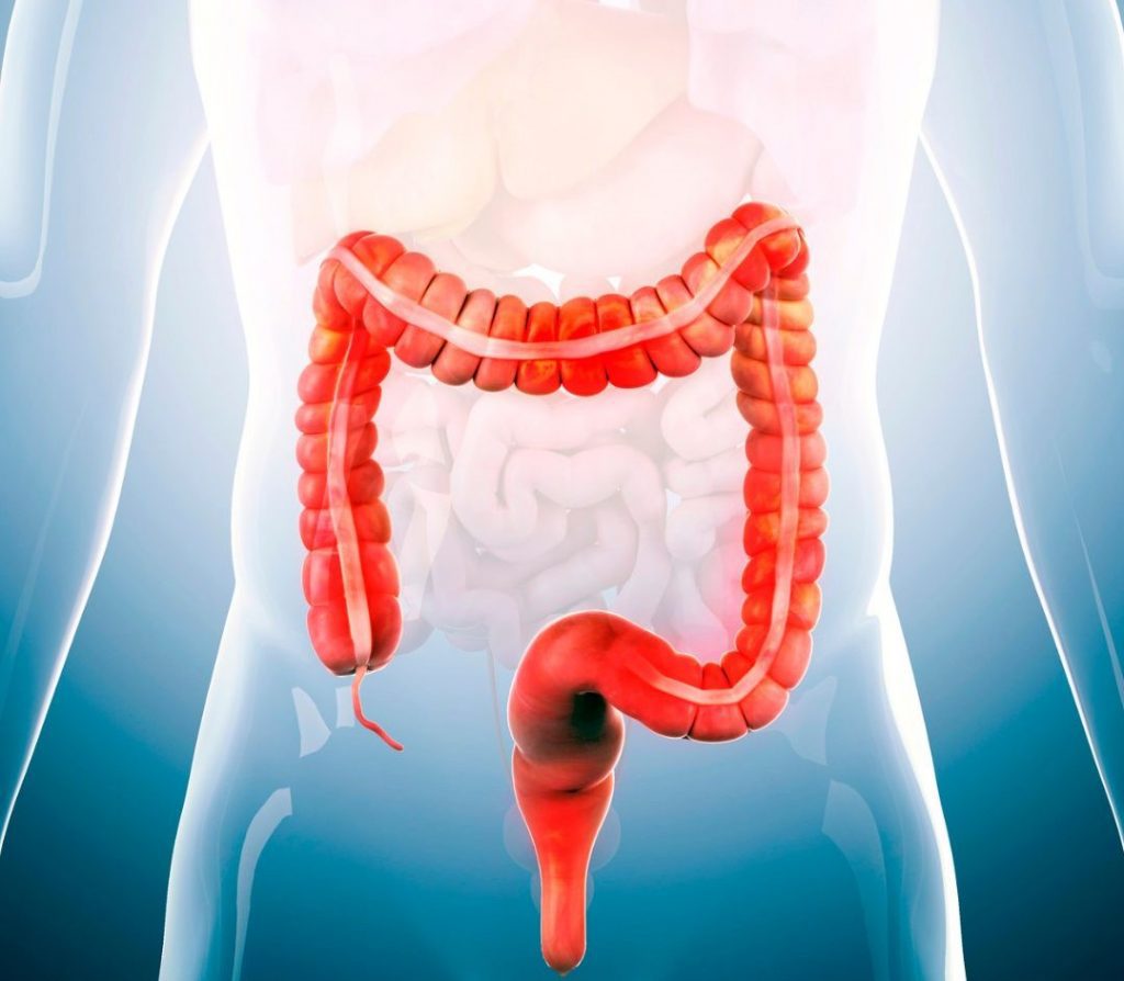 Colon Irritabile e Malattie Intestinali: Cause, Sintomi e Gestione