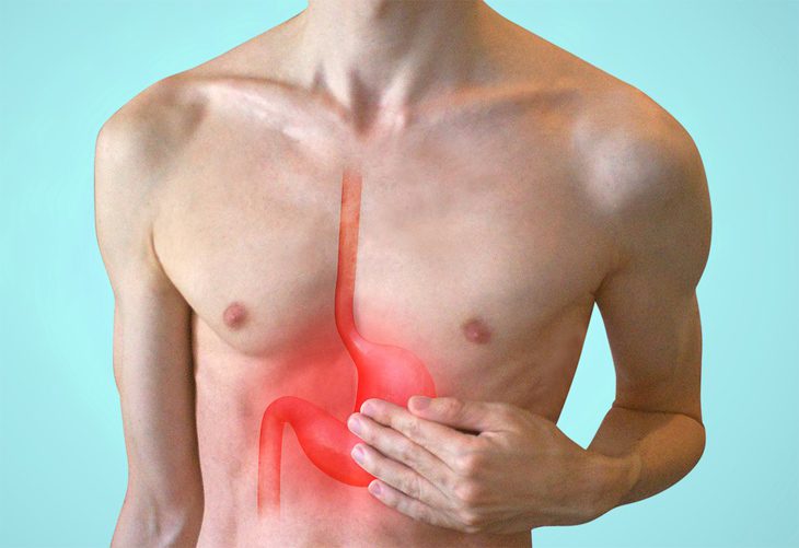 Fermenti Lattici e Gastrite: Un Aiuto per il Benessere dello Stomaco