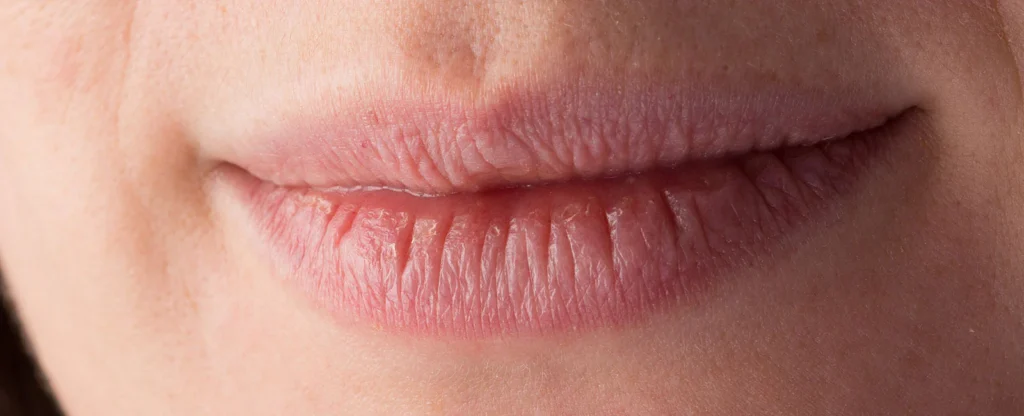 Labbra Sempre Secche: Cause e Soluzioni