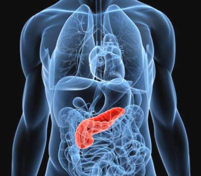 Pancreas Infiammato: Sintomi e Cosa Sapere