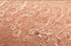 Quanta pelle perdiamo in un giorno?