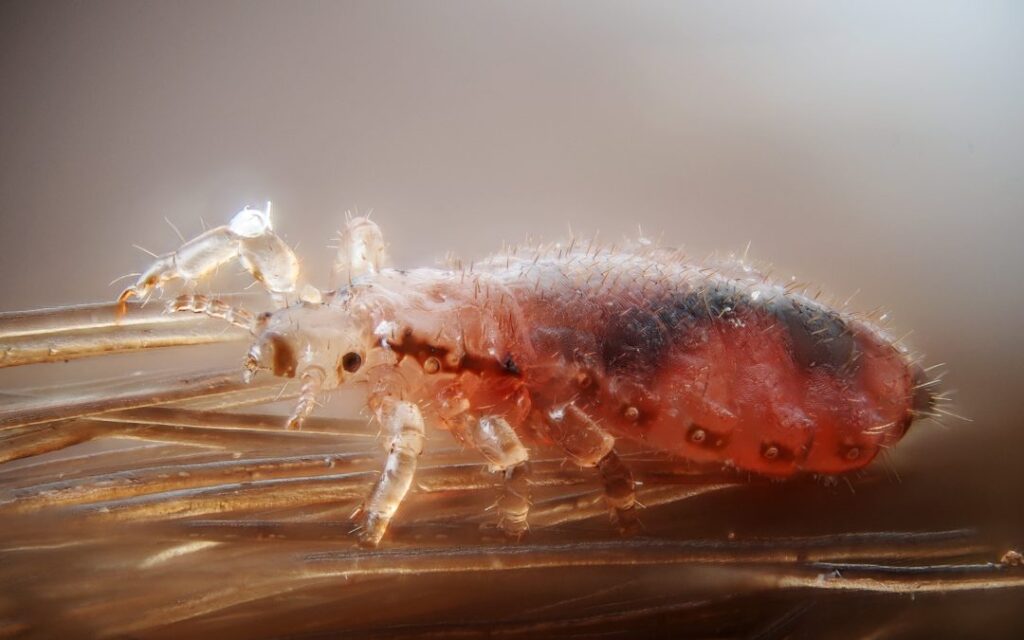 Trattamenti naturali contro i Pidocchi