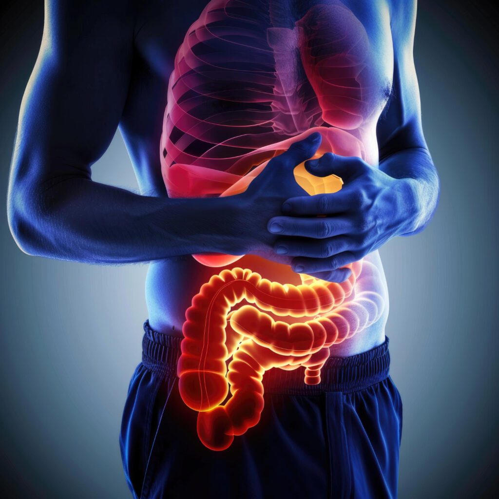 Cura per la disbiosi intestinale