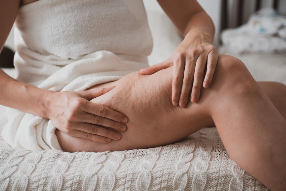 Come Rassodare la Pelle Cadente delle Gambe
