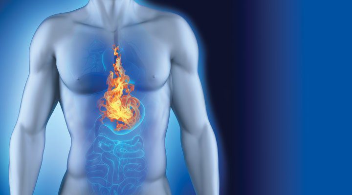 Bruciore di Stomaco Durante la Notte: Cause, Rimedi e Prevenzione