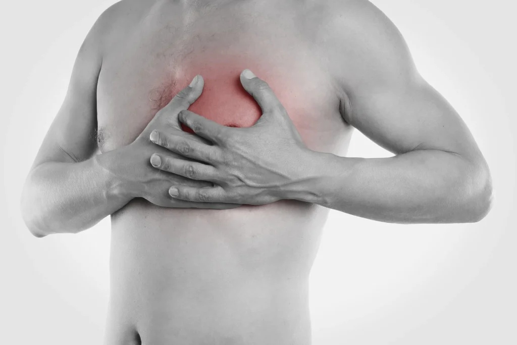 Quanti giorni durano i sintomi dell'infarto