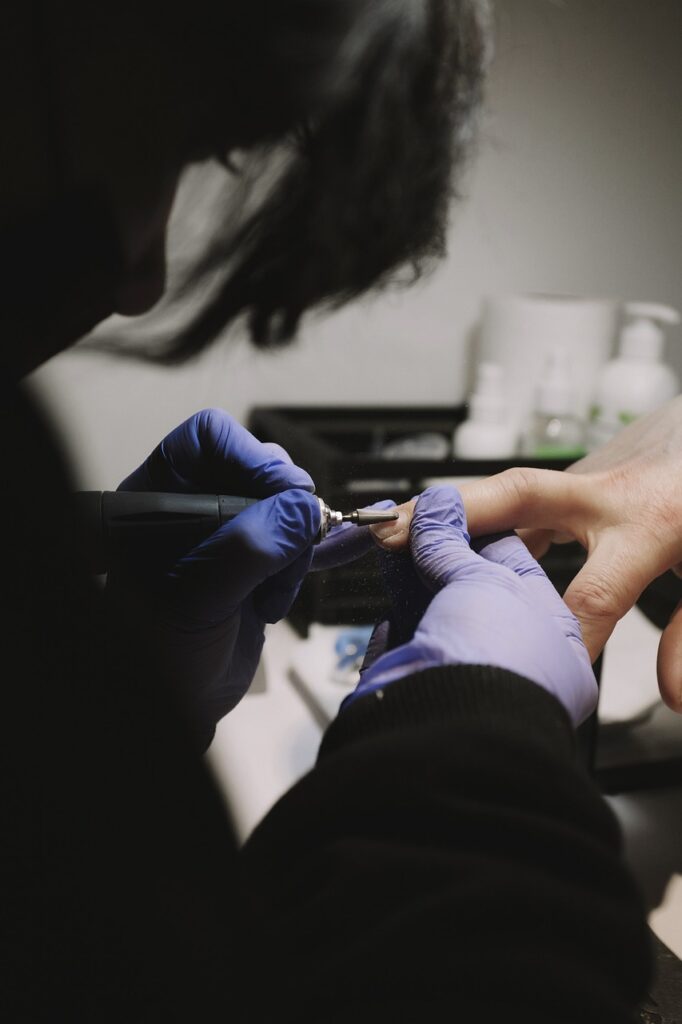 Cura per giradito: come trattare e prevenire l’infiammazione del dito