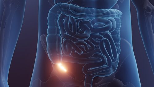 Cosa cambia senza appendice?