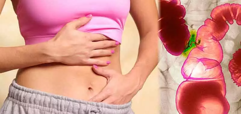Chi soffre di colite cosa non deve mangiare?