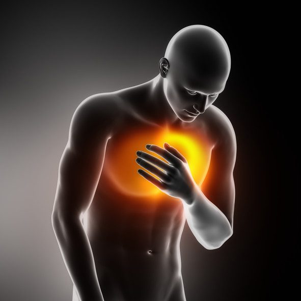 Quanti tipi di infarto al cuore ci sono?