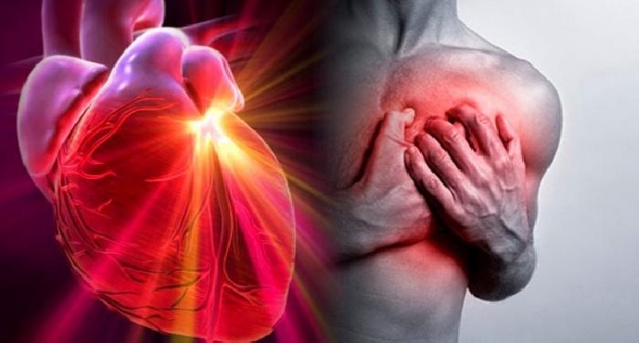 Cosa pu&ograve; causare un infarto fulminante?